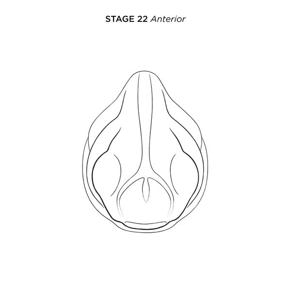 File:MM Xenhead-Stage22-ANT-FL.jpg